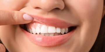 Bir kişinin üst diş etini parmağıyla kaldırarak ağız dokusunu görünür hale getirdiği yakın plan görüntü. Mersin ve Adana bölgesinde diş eti hastalıkları, periodontal sağlık, çene cerrahisi ve implantoloji alanlarında bilgi veren içeriklerde kullanılan görseldir. Diş eti dokusunun temel görünümünü ve periodontal yapıların nasıl incelendiğini açıklayan bilgilendirici makaleleri desteklemek amacıyla tercih edilmiştir.