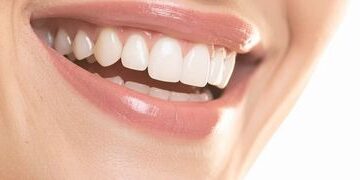 mine-catlaklari-nedir