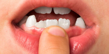 sut-disleri-anatomisi