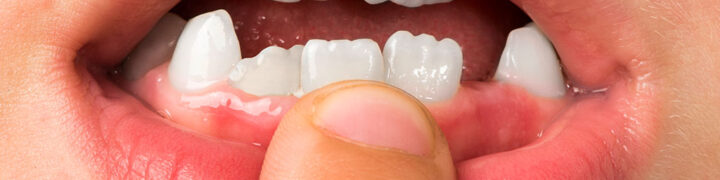 sut-disleri-anatomisi